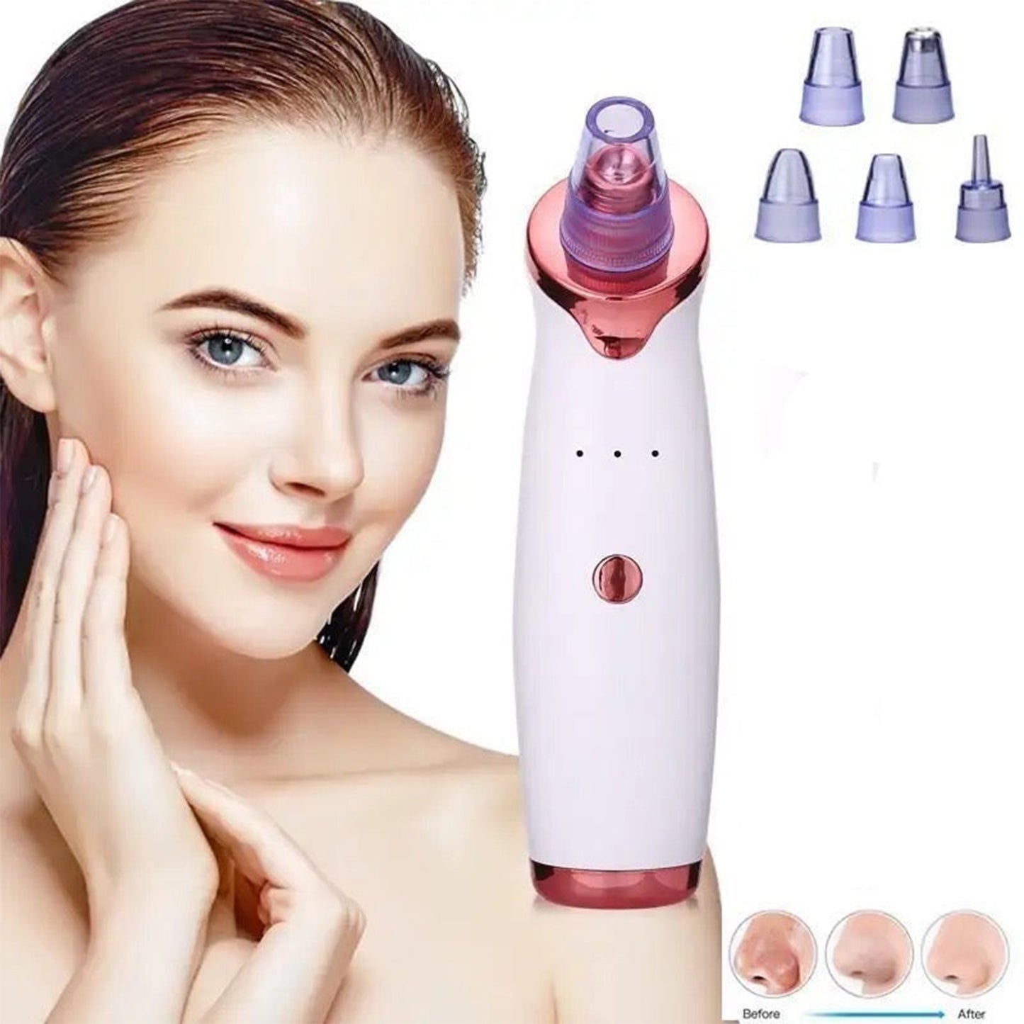 Blackhead Remover Pore Vacuum – 3 Suction Levels, 5 Probes, Face Pore Cleaner