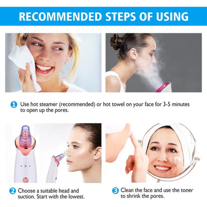 Blackhead Remover Pore Vacuum – 3 Suction Levels, 5 Probes, Face Pore Cleaner